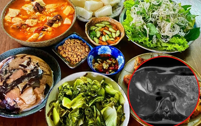 Tình huống phát hiện bệnh